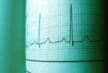 call frequency trend analysis